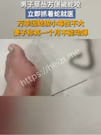 蛇咬事件